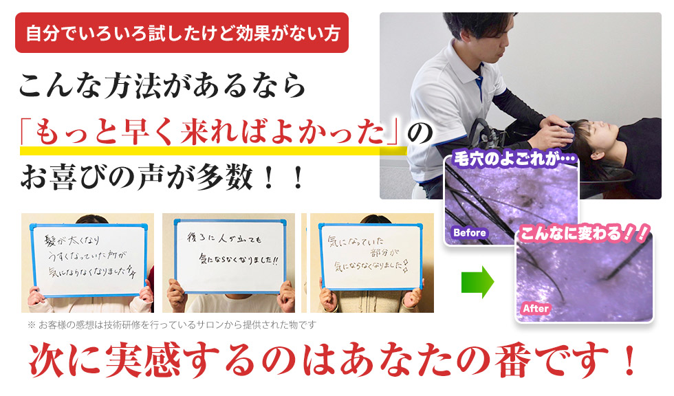 【発毛】自分でいろいろ試したけど効果がない方